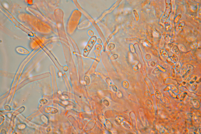 Postia caesia parassitizzata o con forma imperfetta?
